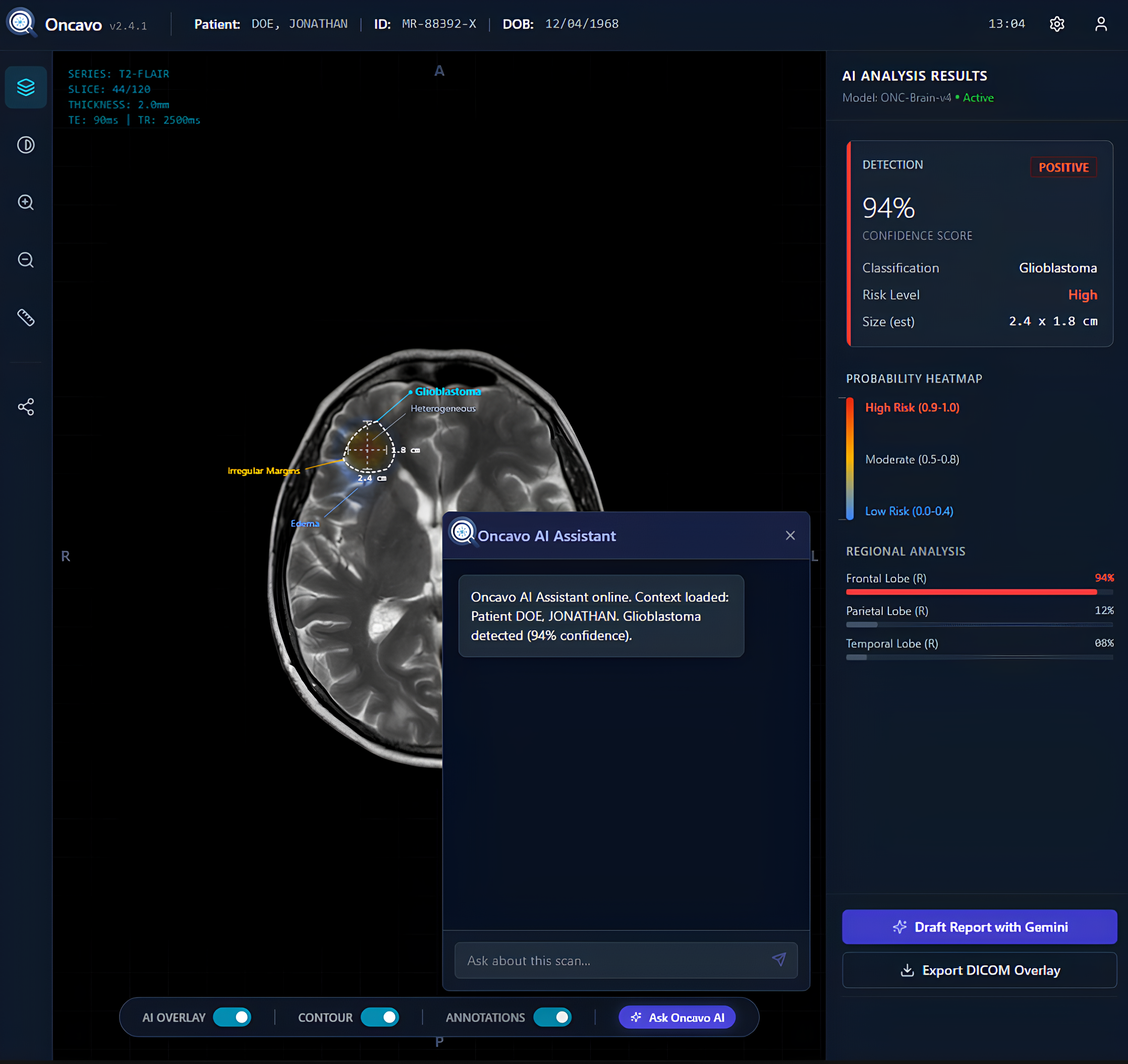 Oncavo system architecture